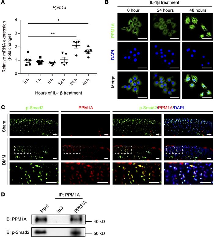 PPM1A interacted with p-SMAD2 in articular chondrocytes.
(A) Fold change...