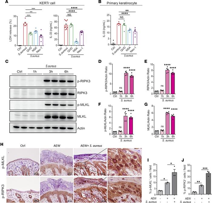 
S. aureus–exacerbated dermal IL-33 release is associated with necroptos...