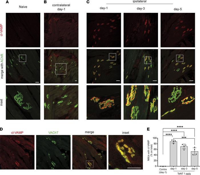 TeNT cleaves its target VAMP at motor axon terminals of the WP in mice.
...