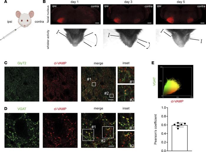 TeNT activity in the brainstem after injection in the WP is found at the...