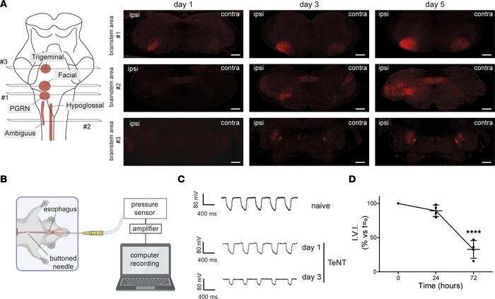 TeNT activity in the brainstem after injection in the WP rapidly spreads...