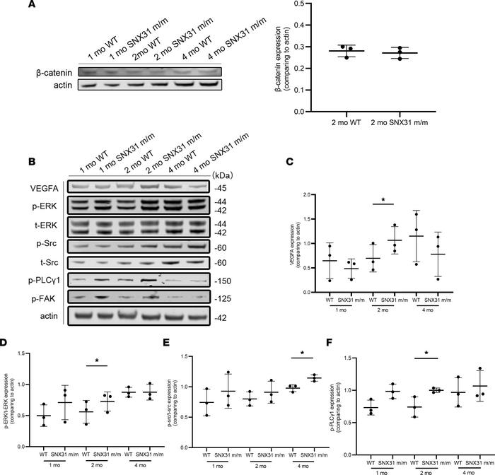 VEGF pathway–related molecules may be related to retinal vascular defect...