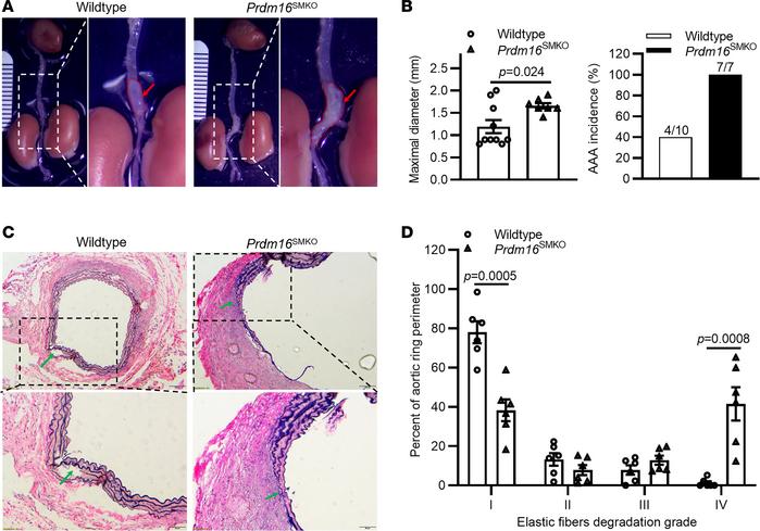 VSMC-specific Prdm16 knockout aggravates elastase-induced abdominal aort...