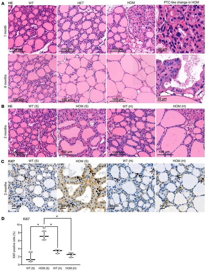 Thyroid histology of knockin mice carrying a constitutively active TSHR ...