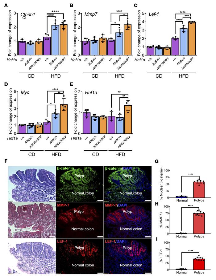 Loss of HNF1A function resulted in Wnt/β-catenin pathway activation and ...