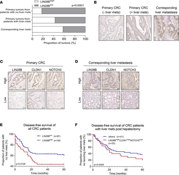 LIN28B/CLDN1/NOTCH3 axis positively correlates with metastatic progressi...