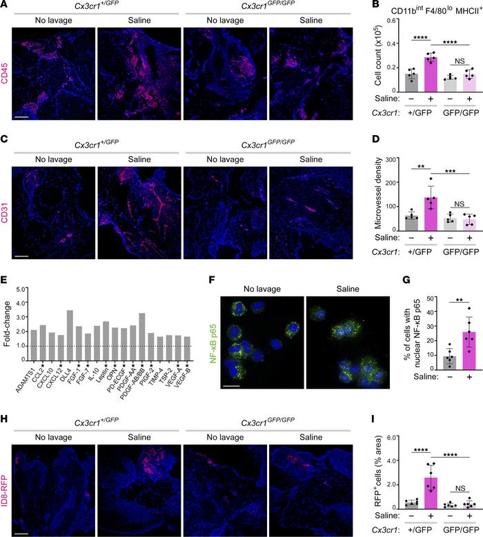 Normal saline promotes omental neoangiogenesis and cancer cell implantat...
