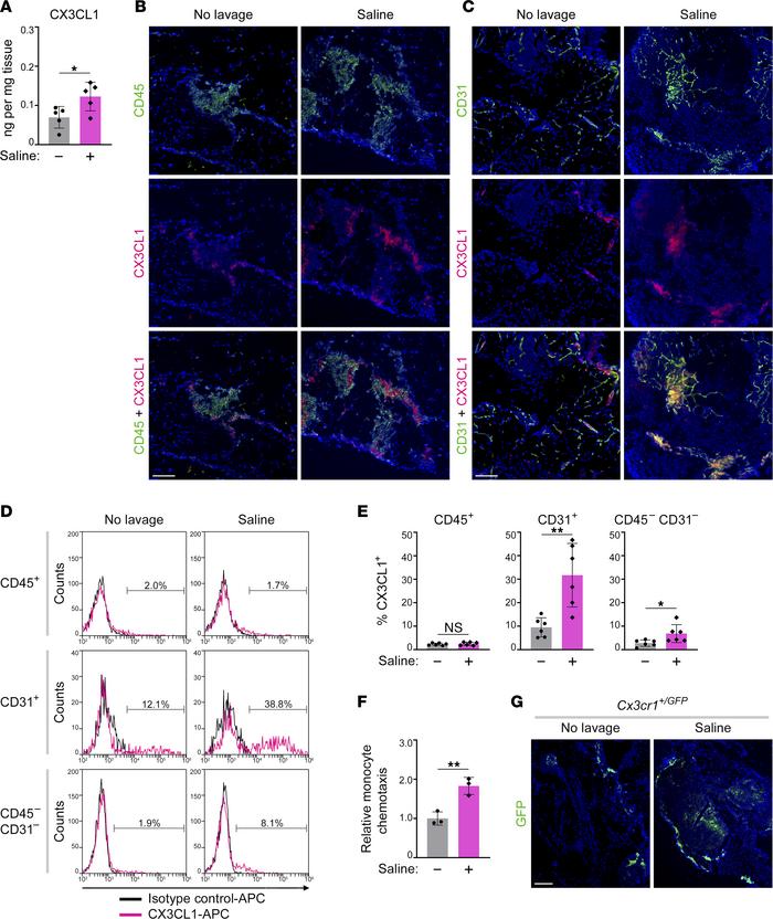 Normal saline increases expression of CX3CL1 within and surrounding the ...