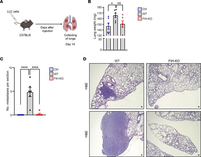 FIH promotes lung metastasis in vivo.
(A) Schematic representation of th...