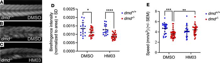 BiP inhibition rescues muscle function in DMD.
(A–C) Representative bire...