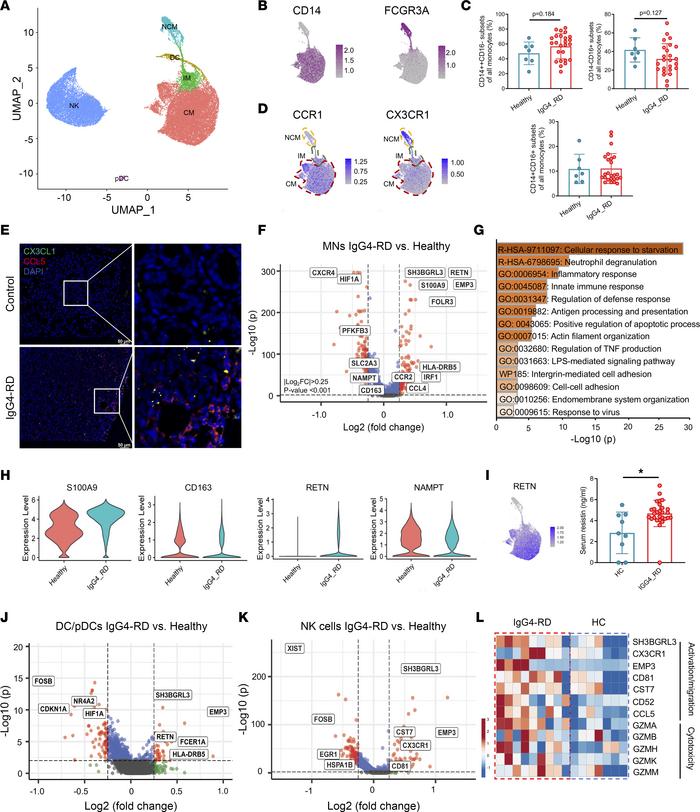 Detailed characterization of other immune cells in IgG4-RD.
(A) UMAP plo...