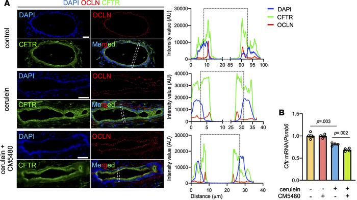CM5480 treatment restores CFTR localization in CP.
(A) Immunofluorescenc...