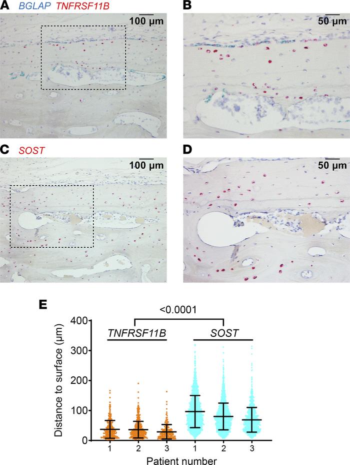 Human osteocytes expressing TNFRSF11B reside near the bone surface.
(A a...