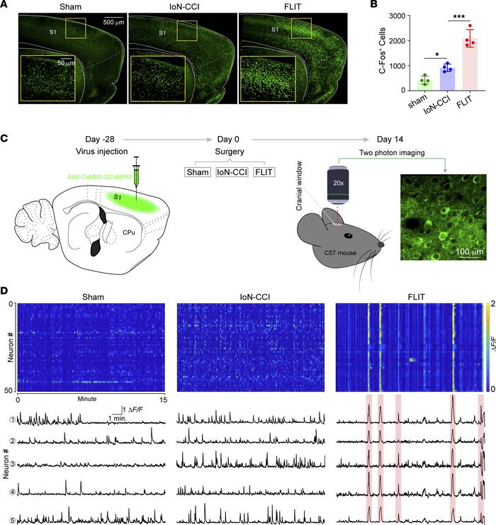 Unique cortical neural activation pattern in the FLIT model.
(A and B) c...