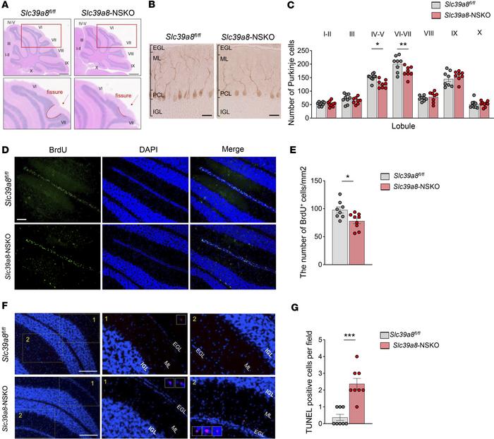 Morphological defects, reduced neurogenesis, and accelerated apoptosis i...