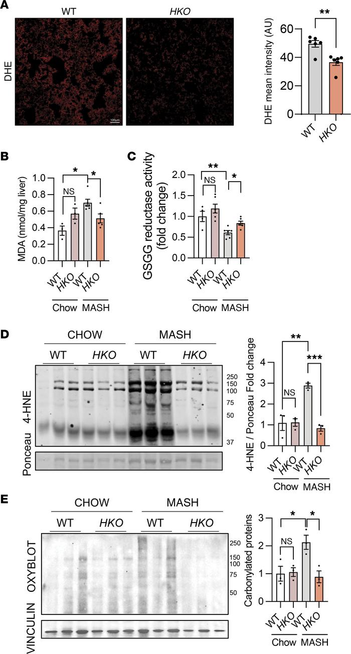 miR-33 HKO mice have reduced oxidative stress and cell death in MASH liv...