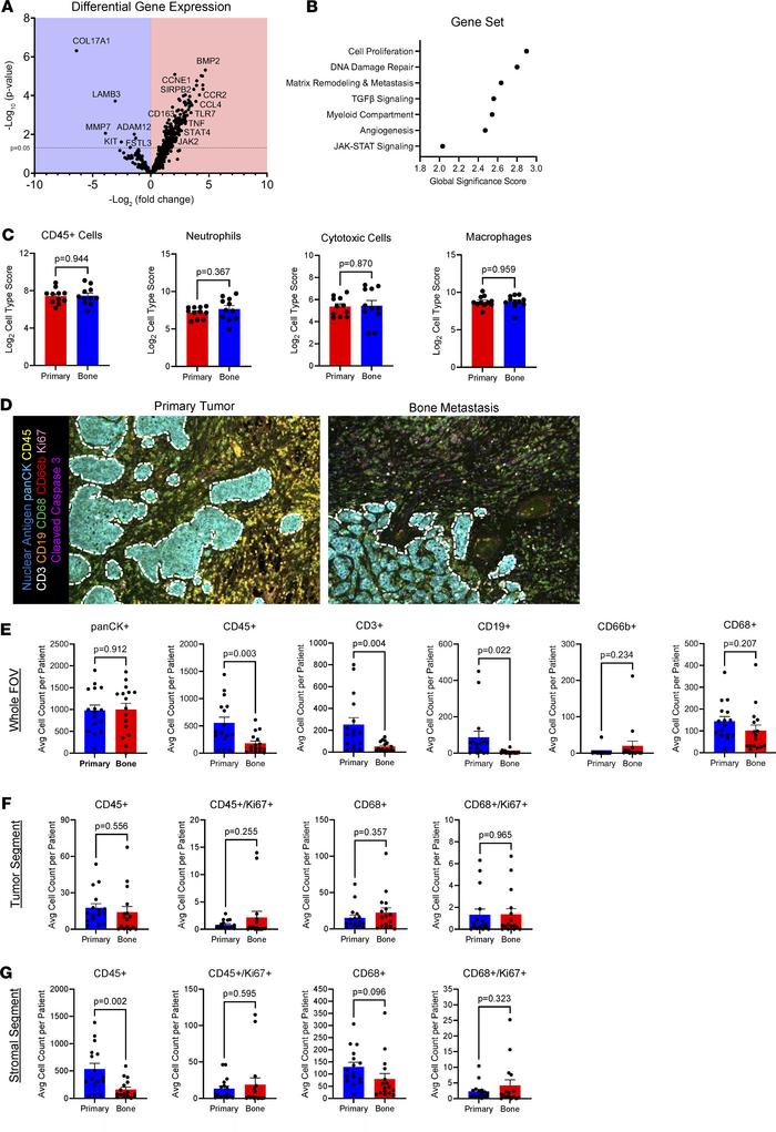 Comparative analysis of human breast cancer primary tumor and bone metas...