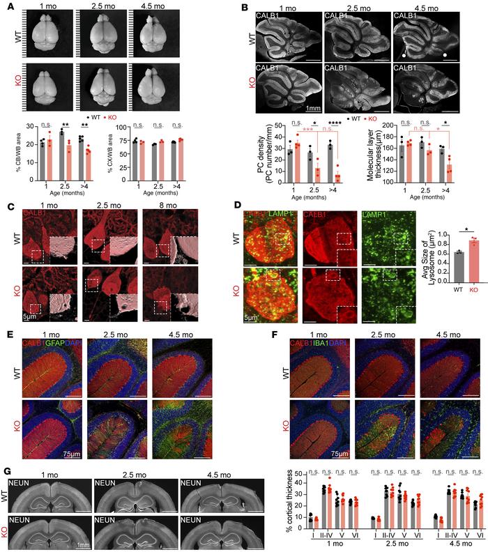 SNX14 deficiency causes selective cerebellar degeneration.
(A) Represent...