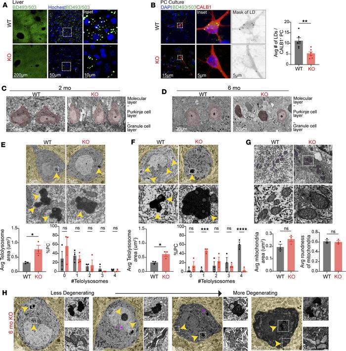 Lipid storage organelles are affected in SNX14-deficient tissue.
(A) Rep...