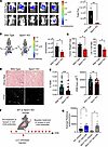 Reduced tumor formation and collagen production in the absence of Spon1.