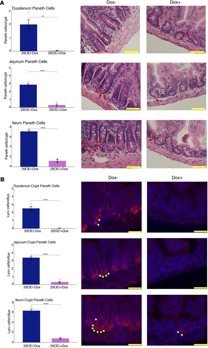 Gain of miR-29b leads to loss of Paneth cells.
(A) Paneth cell counts pe...