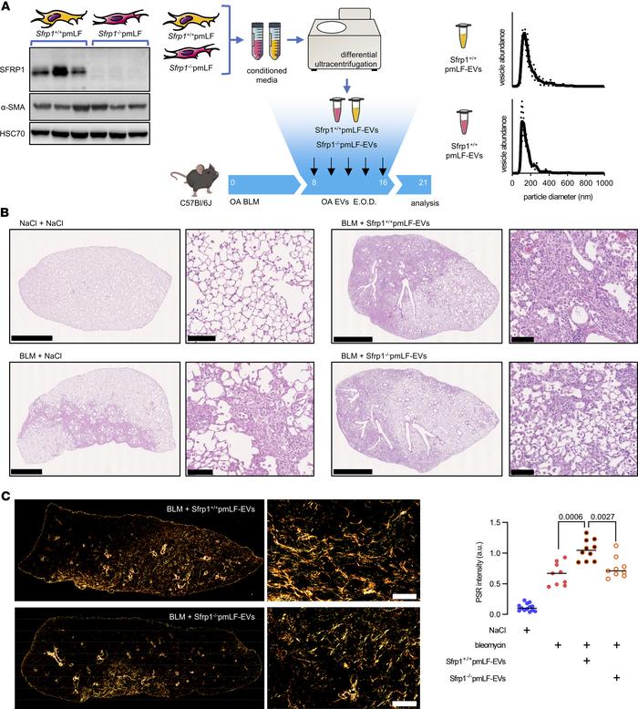 
Sfrp1 deficiency in fibroblast-derived EVs attenuates lung fibrosis in ...