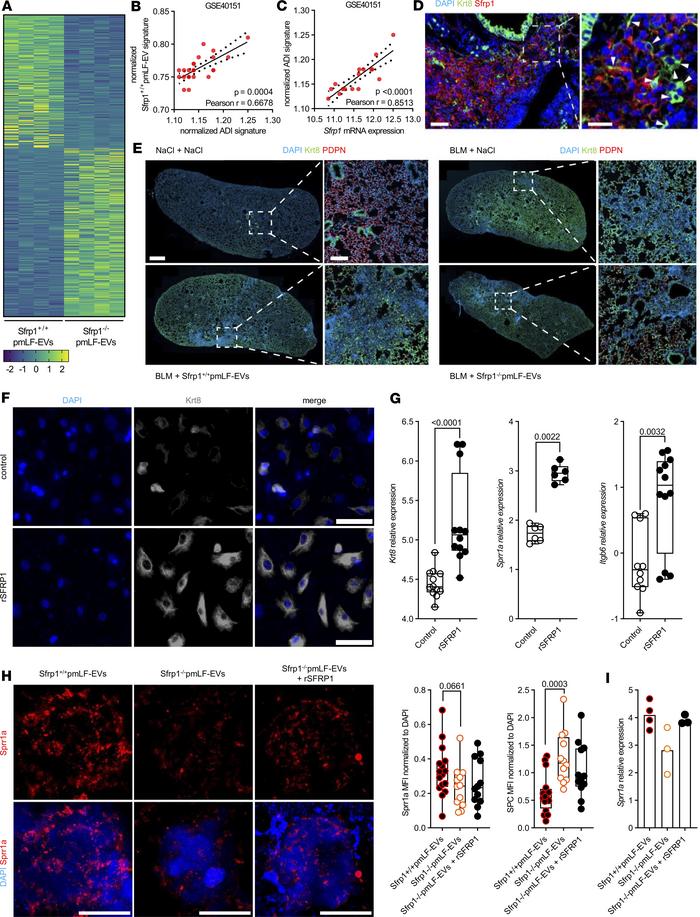 SFRP1-EVs promote the accumulation of keratin 8–positive expressing AT2 ...