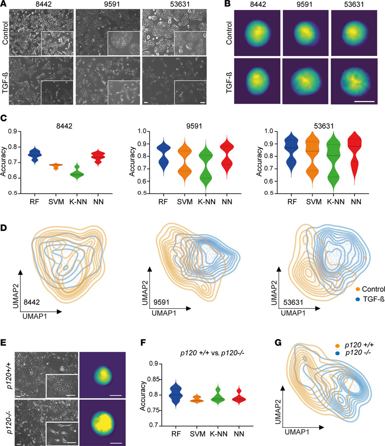 DHM-based identification of TGF-β– and genetically induced EMT.
(A) Phas...