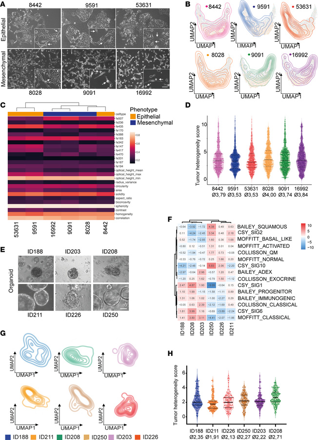 Single-cell phenotyping identifies heterogeneity in murine and human PDA...
