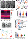 Single-cell phenotyping identifies heterogeneity in murine and human PDAC m