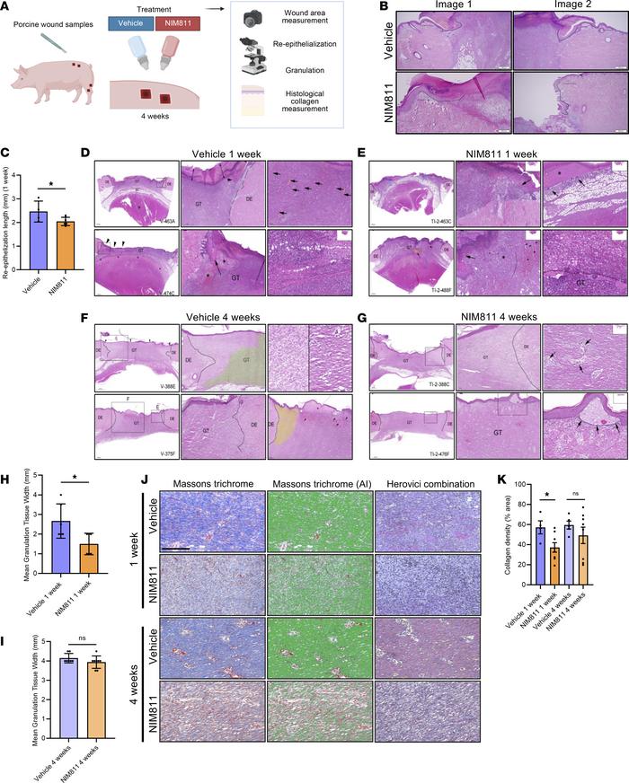 Cyclophilin D inhibition impairs porcine wound closure, granulation, and...