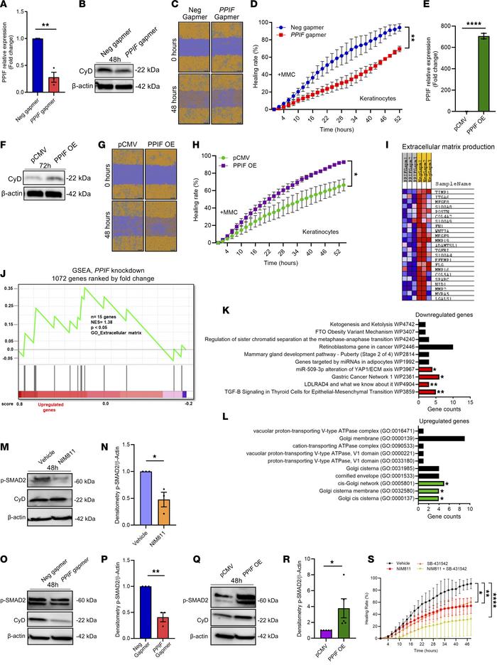 Cyclophilin D promotes keratinocyte migration and affects expression of ...