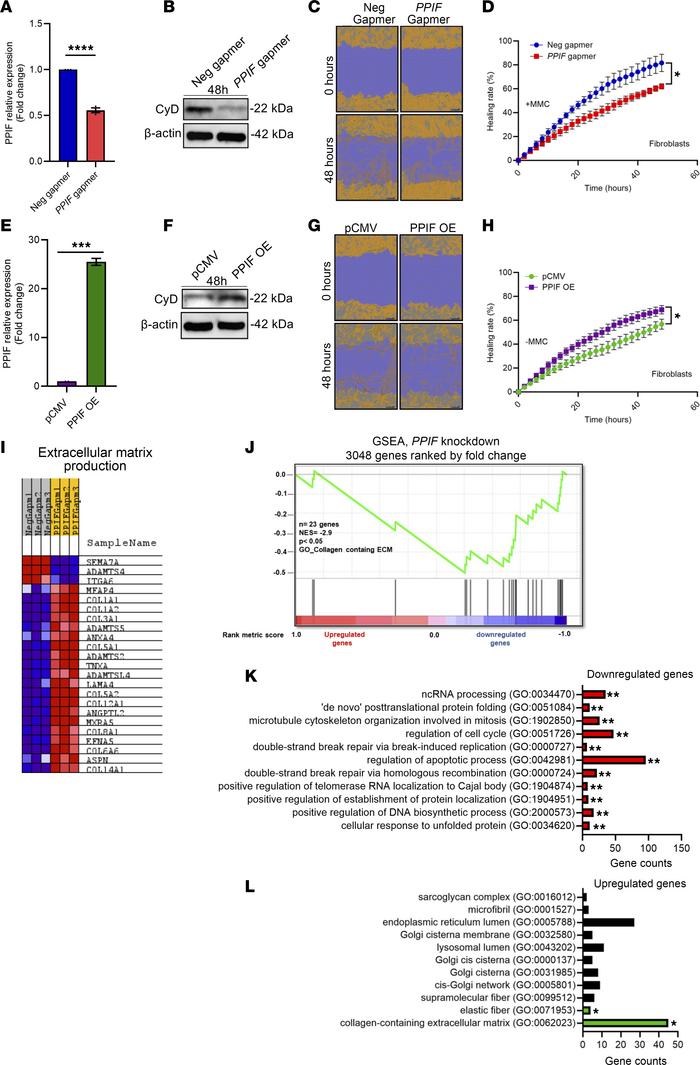 Cyclophilin D promotes fibroblast proliferation but not migration.
(A an...