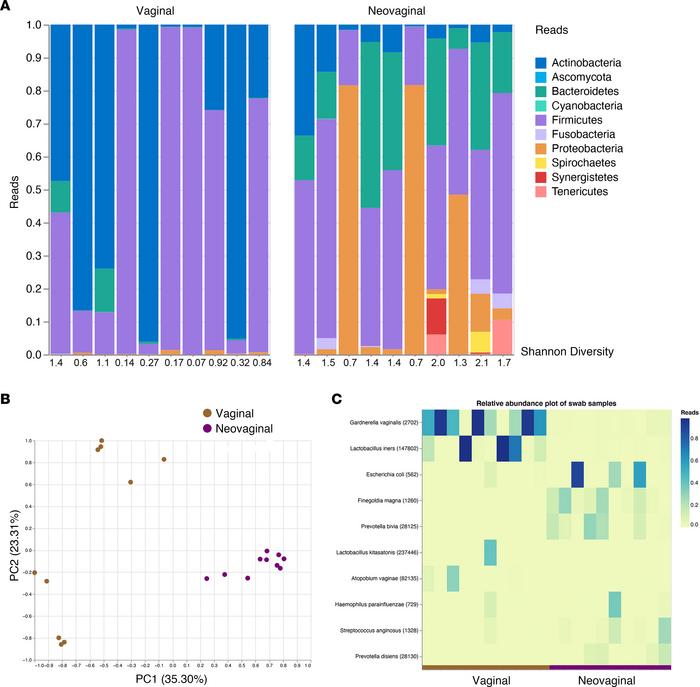 Microbial profiles determined by 16s rRNA sequencing revealed distinct m...