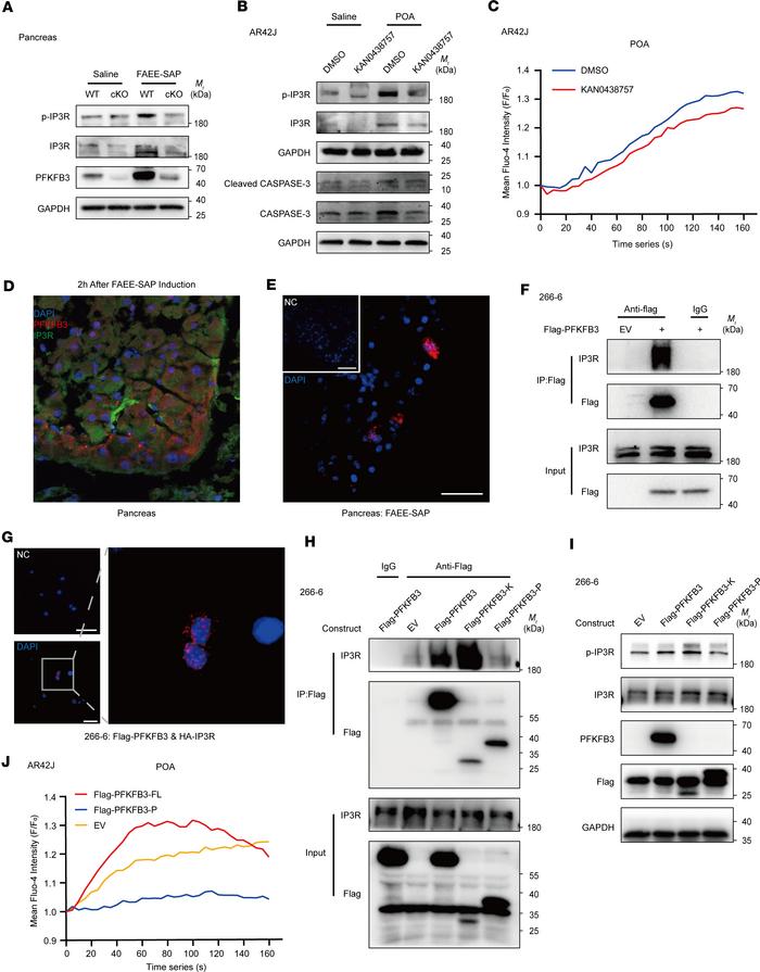 PFKFB3 cooperates with IP3R to regulate calcium homeostasis in pancreati...