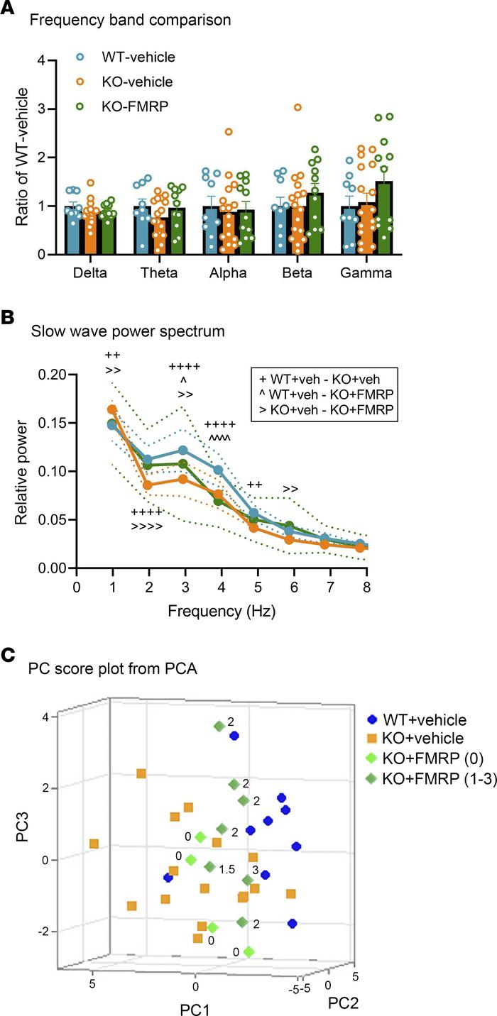 Results of the EEG recordings and principal component analysis.
(A) EEG ...