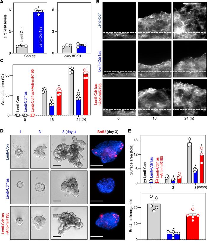 
Cdr1as inhibits intestinal epithelial repair after wounding and decreas...