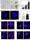 Cdr1as deletion increases the growth of intestinal organoids.