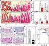 Targeted deletion of Cdr1as enhances injury-induced epithelial regeneration