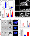 Cdr1as inhibits intestinal epithelial repair after wounding and decreases g