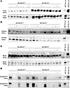 Hif1a and Hif2a protein levels are increased in livers of Slc30a10–/– mice.
