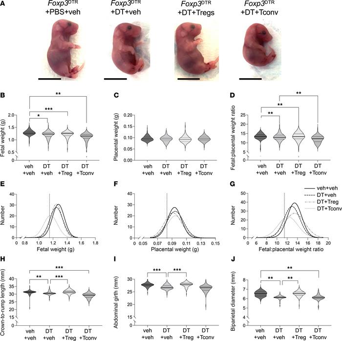 Treg cell depletion in the peri-implantation period causes fetal growth ...