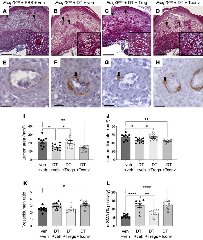 Treg cell depletion impairs spiral artery remodeling in midgestation.
Pr...