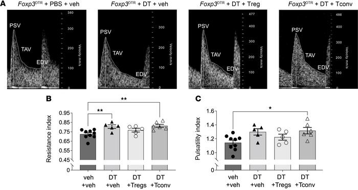 Uterine artery resistance in midgestation is increased by Treg cell depl...