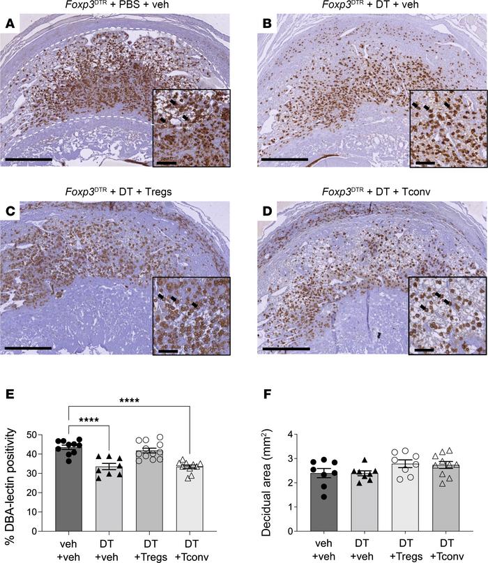 Treg cell depletion causes a reduction in DBA+ uNK cells in midgestation...