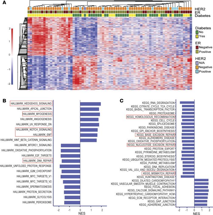A distinct transcriptome profile in breast tumors of patients with diabe...