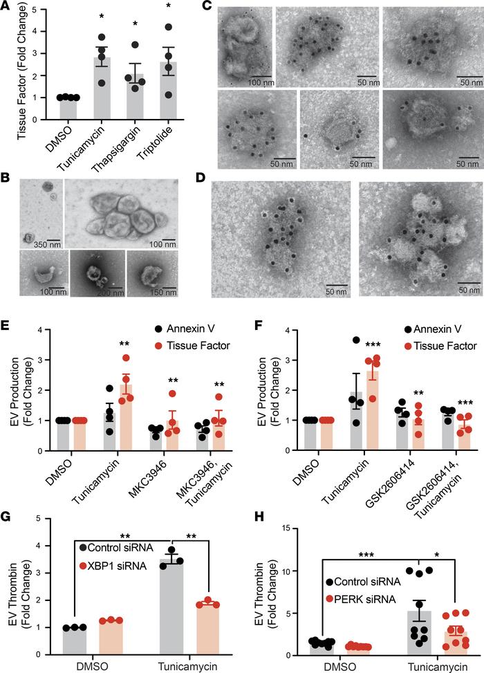 UPR induction in pancreatic cancer cells stimulates production of TF-bea...