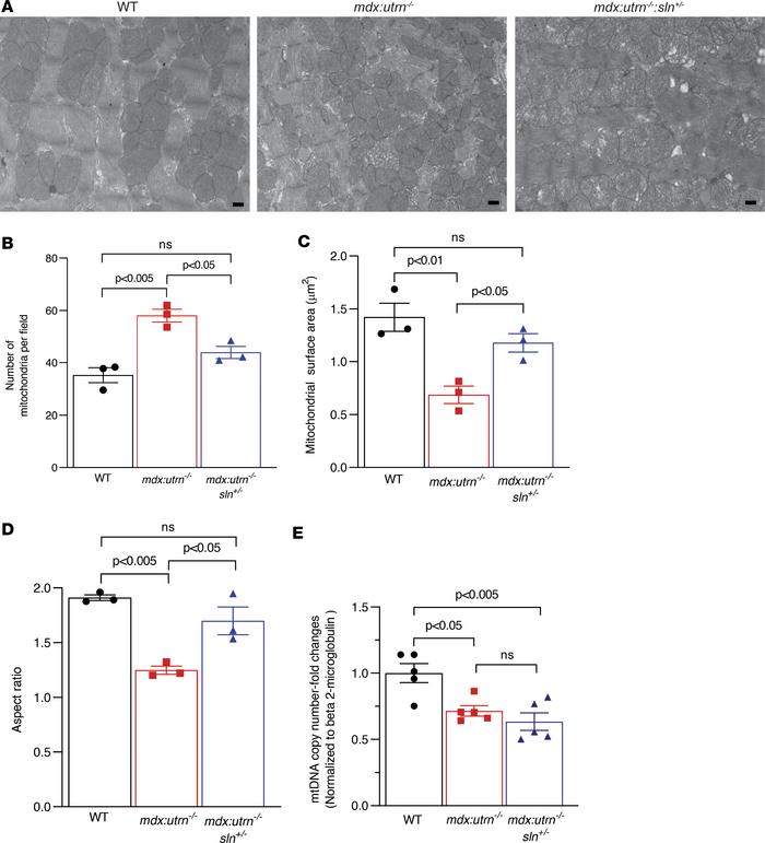 Improved mitochondrial structure in mdx:utrn–/–:sln+/– ventricles.
(A) R...