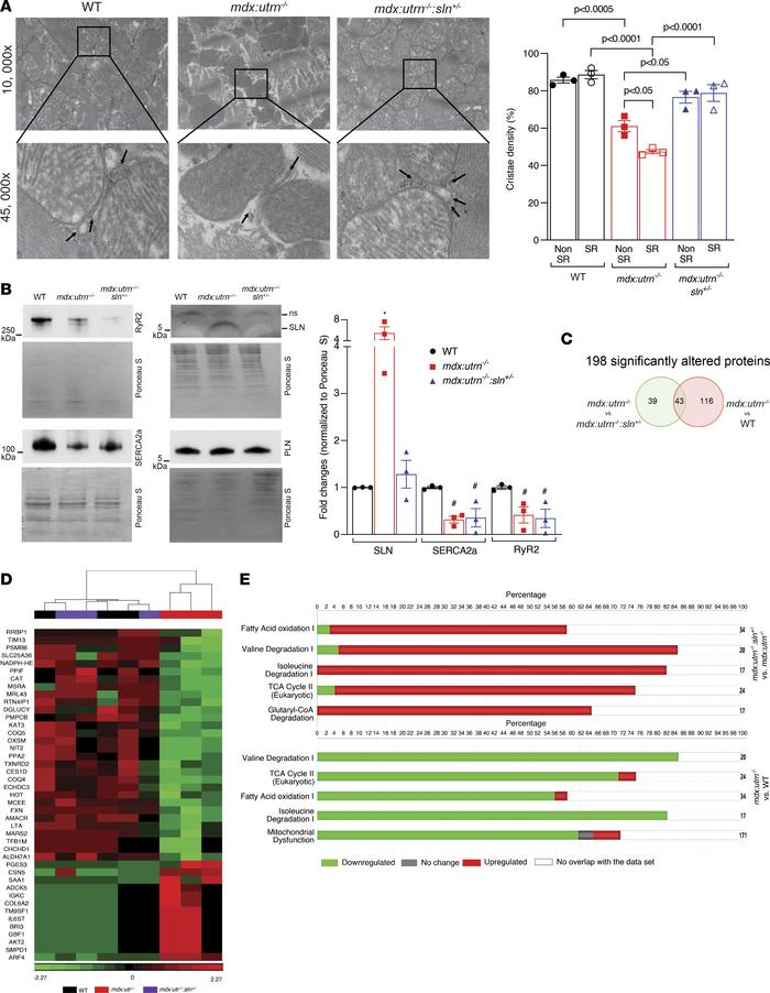 Improved mitochondrial structure and MAMs in mdx:utrn–/–:sln+/– ventricl...