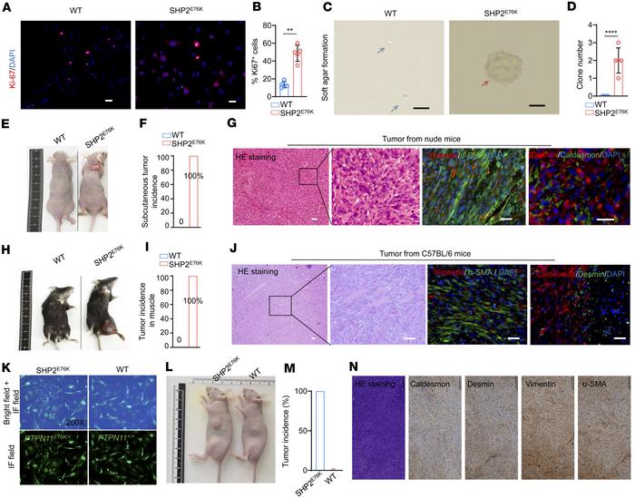 MSCs with the SHP2E76K mutation undergo malignant transformation and mod...